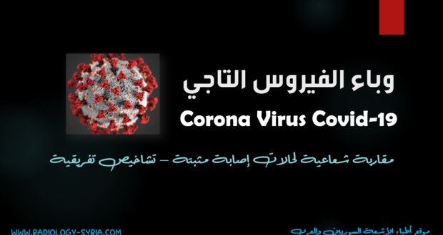 مقاربة شعاعية فيروس كورونا